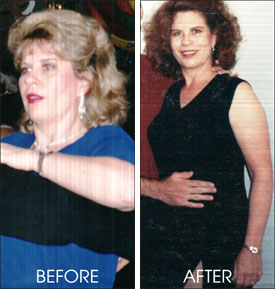 Janis Pullen - Weight Loss - Before & After